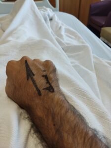 Surgeon signature before kidney transplant surgery